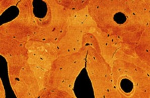 quantitative backscattered electrom imaging